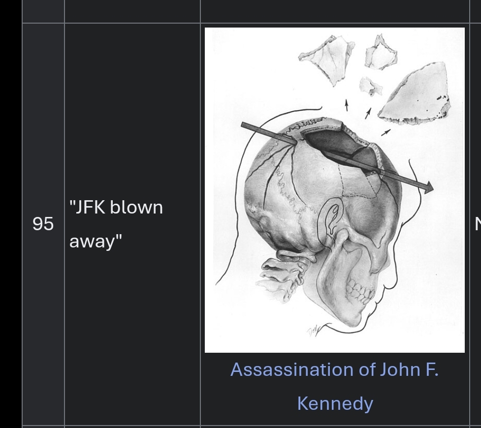 "JFK blown away" with a link to the Wikipedia page of JFK's assassination alongside a forensic drawing of JFK's head during the event. Wikipedia probably has better alt text, check there.