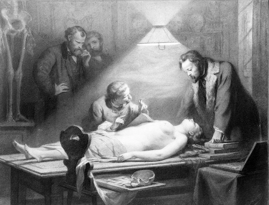 Drawing of anatomists around a cadaver. One is smoking.