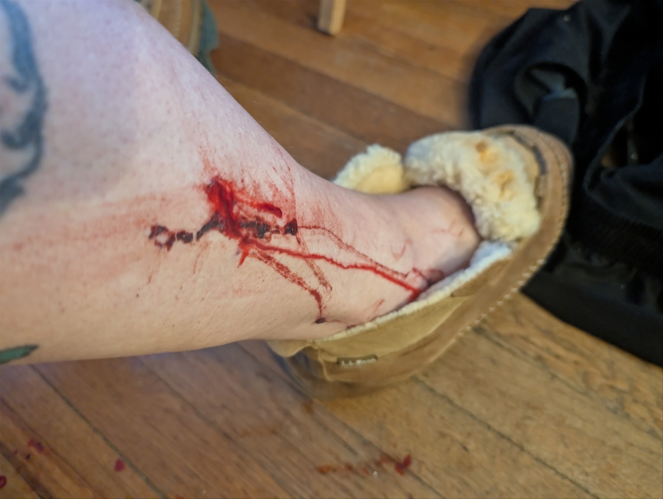 Cat scratch fever! 